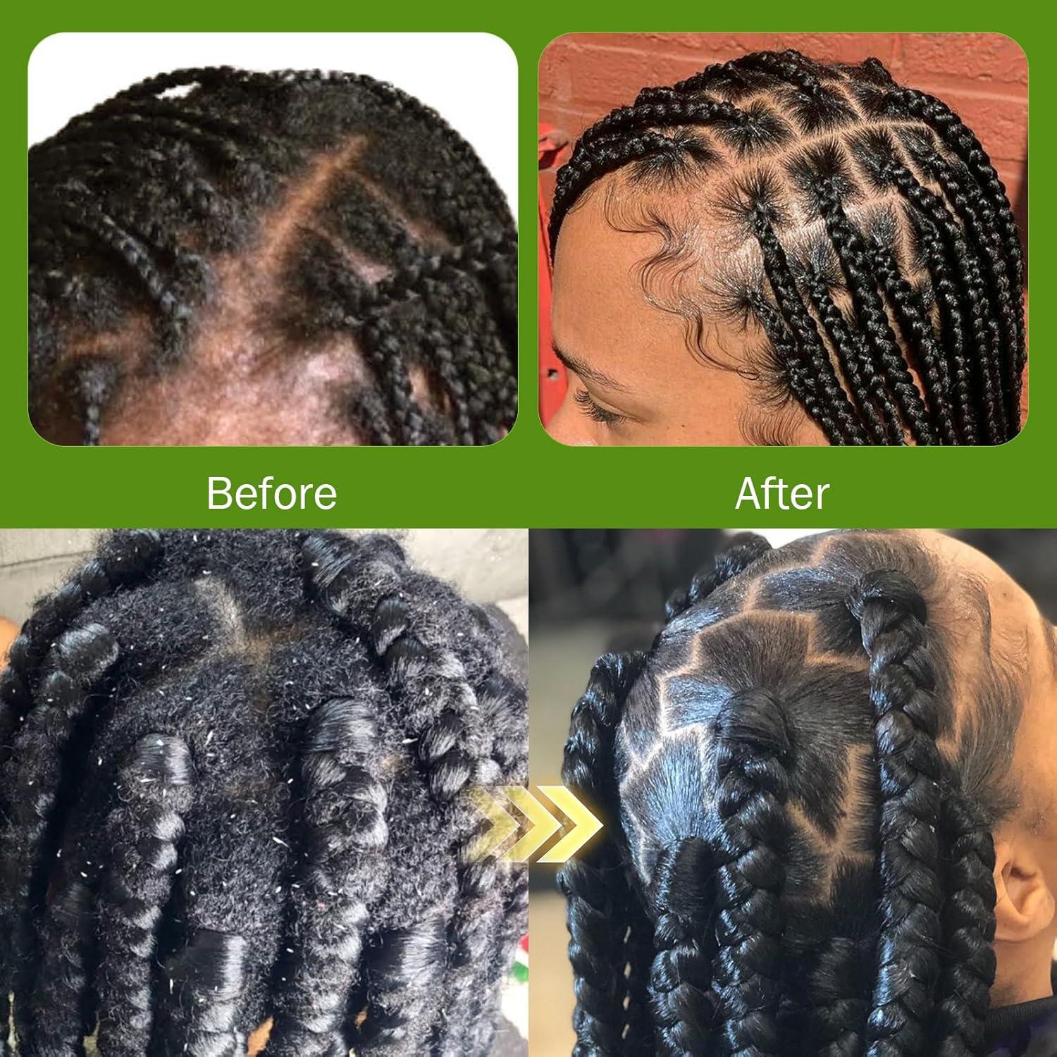 imageBraid Foam Control Mousse Braiding Mousse NoWater Braid Shampoo for Braids Twist Locs Hair Foaming No Flake Extra Hold RinseFree Dreadlock Shampoo for BuildUp Odor Itch amp Flakes2PCSBSRBB3pcs