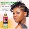 Braid Oil for Soothes Moisturizes Dry & Itchy Scalp- Braid Care for Dandruff and Thinning Edges- Braiding Scalp Oil for Locs & Twists Enhances Shine and Reduces Frizz Refreshes Dry Hair 8 fl oz