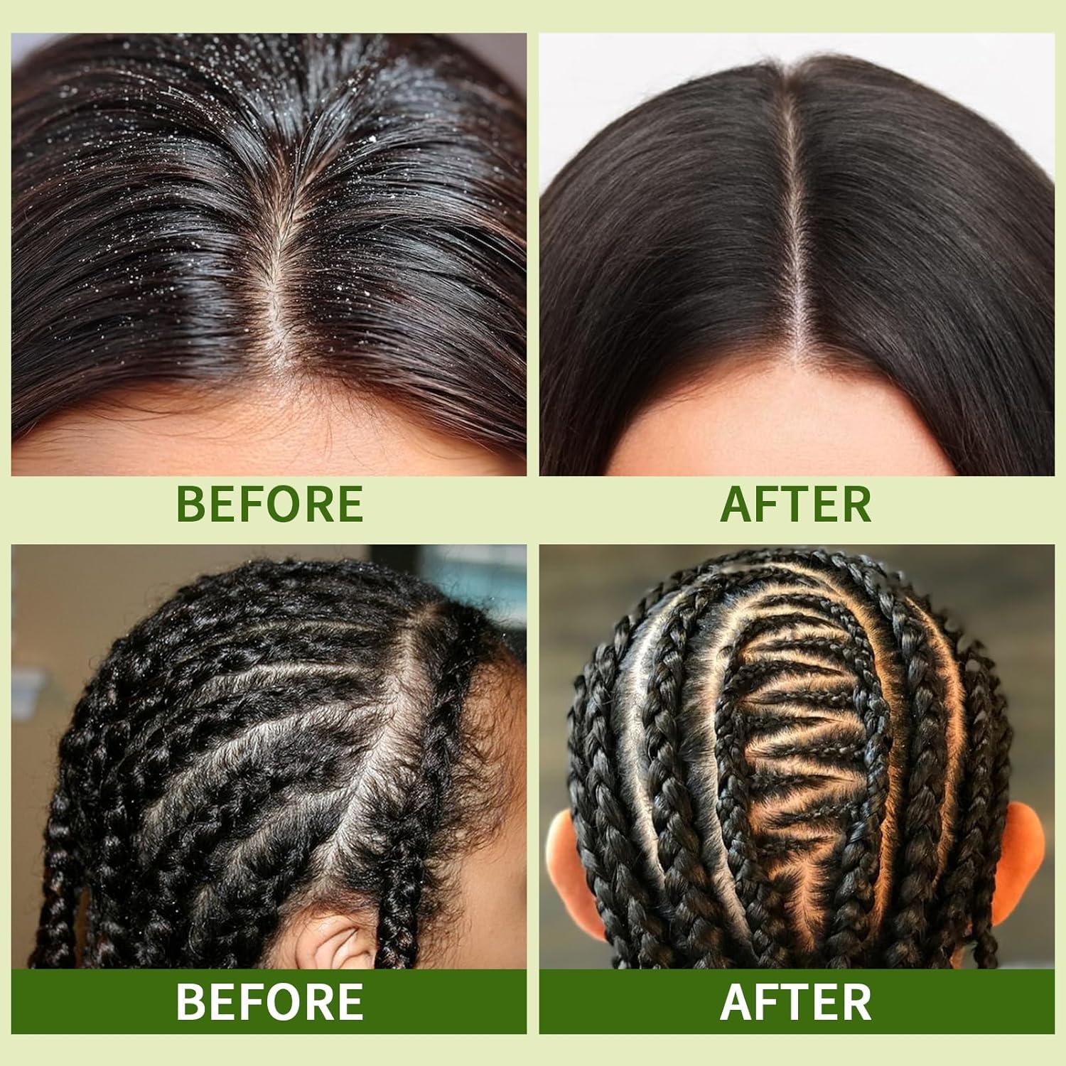 imageLoc Shampoo Bar amp Conditioner Braid Shampoo Bar Works for Dreadlocks Microlocs Sisterlocks Braids Remove Product Rose Water for Hair Loc Spray Moisturizing Refreshing amp Wooden Holder